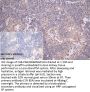 PTBP3 Antibody