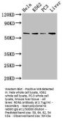 RORA Antibody