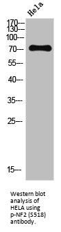 Phospho-NF2 (S518) Antibody