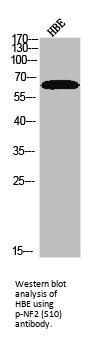 Phospho-NF2 (S10) Antibody