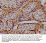 RPIA Antibody