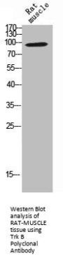 NTRK2 Antibody