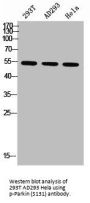 Phospho-PARK2 (S131) Antibody