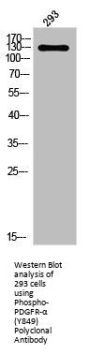 Phospho-PDGFRA (Y849) Antibody