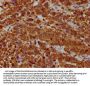 RPP38 Antibody