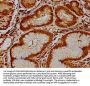 RPP38 Antibody
