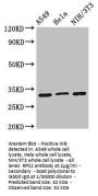 RPS2 Antibody
