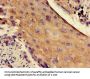 RPS4Y1 Antibody