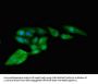 RPS4Y1 Antibody
