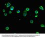 RPS6 Antibody