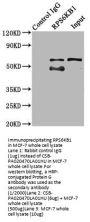 RPS6KB1 Antibody