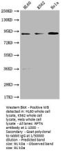 RPTN Antibody