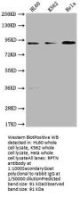 RPTN Antibody