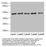 RRM2 Antibody