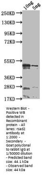 rsad2 Antibody