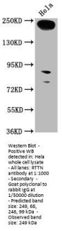 RTTN Antibody