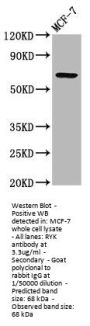 RYK Antibody