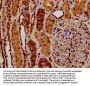 RYK Antibody