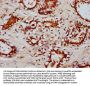 RYK Antibody