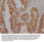 S100A12 Antibody