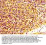 S100A4 Antibody