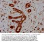 S100A7 Antibody