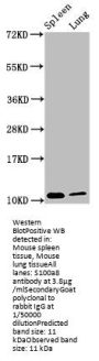 S100a8 Antibody
