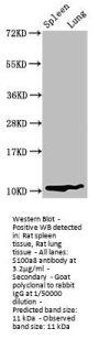 S100a8 Antibody