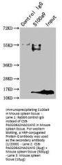 S100a9 Antibody