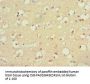 S100B Antibody