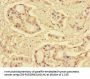 S100P Antibody