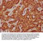 SAA2 Antibody