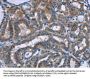 PLIN1 Antibody