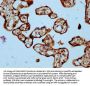 SASH1 Antibody