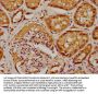 SBK2 Antibody
