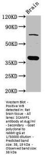 SCAMP1 Antibody
