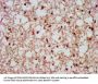SCAMP1 Antibody