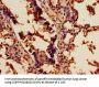 SCD Antibody