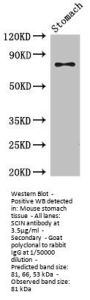 SCIN Antibody