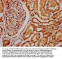 SCLY Antibody