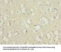 SCN2B Antibody