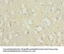 SCN2B Antibody