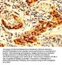 SCNN1B Antibody