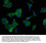 SCNN1B Antibody
