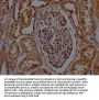 SDHB Antibody