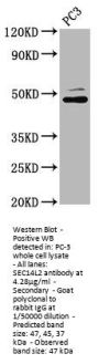 SEC14L2 Antibody