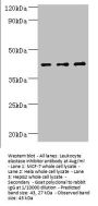 SERPINB1 Antibody
