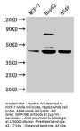 SERPINB1 Antibody