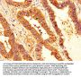 SERPINB1 Antibody