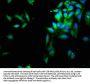 SERPINB1 Antibody